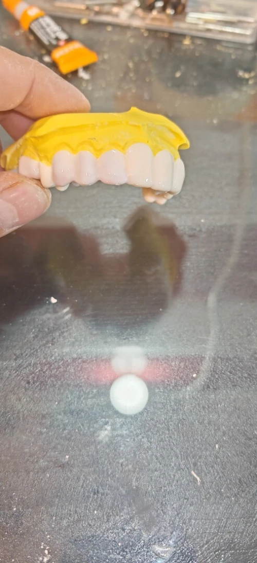 Snap on smile