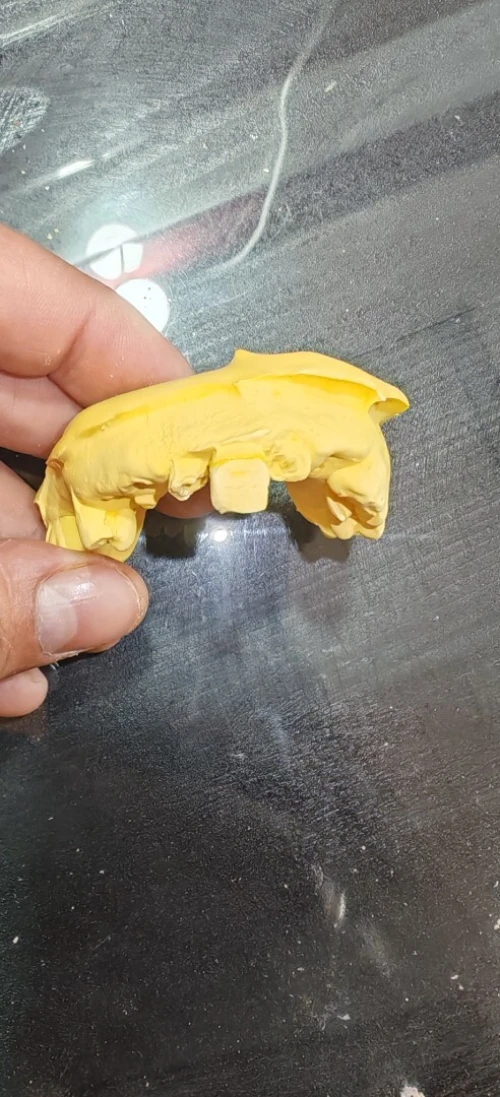 Snap on smile