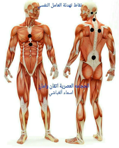 Hidjama-الحجامة الوقائية والعلاجية للرجال والنساء