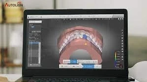 Autolign 3d Diorco 2022