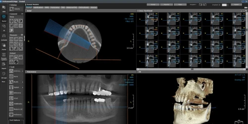 OnDemand3D Dental 2022