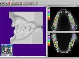 Autolign 3d Diorco 2022
