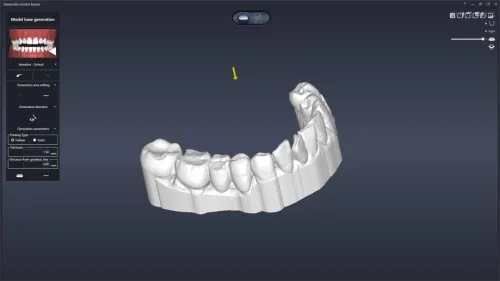DentiqGuide 