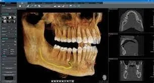 CS 3D Imaging 3.10.21