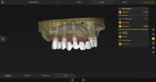 InLab CAD SW 22.1