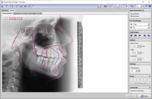 OnyxCeph 2025 (Build 3.2.233)