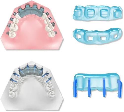 Maestro 3D Dental Studio V6