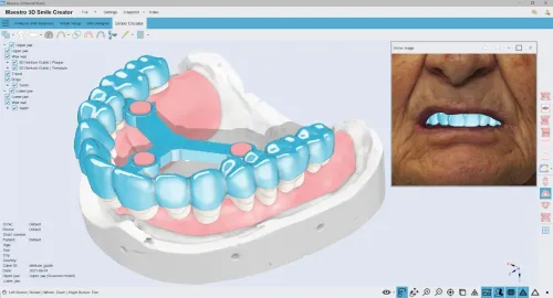 Maestro 3D Dental Studio V6