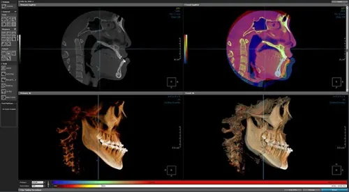OnDemand3D Dental 2024