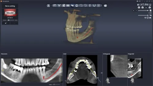 DentiqGuide 