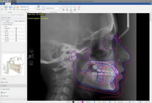 AudaxCeph Ultimate 6.6.12.4731 (2025)