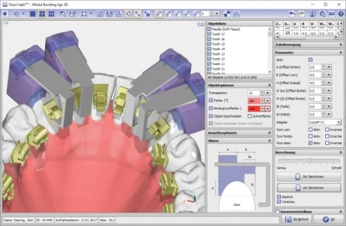 OnyxCeph 2025 (Build 3.2.233)