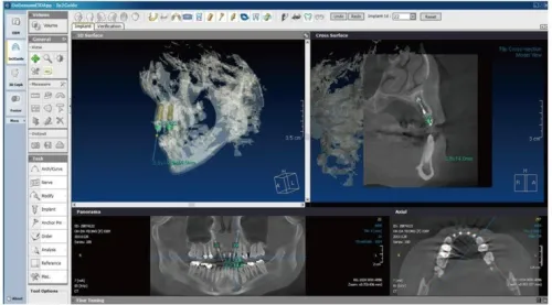 OnDemand3D Dental 2024
