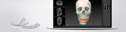 IPS CaseDesigner 2.5.7.1 (2024)
