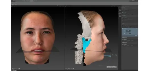 IPS CaseDesigner 2.5.7.1 (2024)