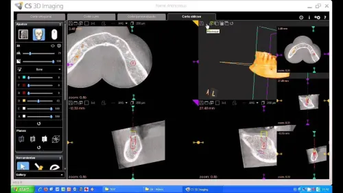 CS 3D Imaging 3.10.21