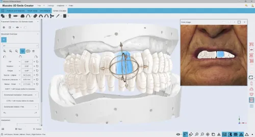 Maestro 3D Dental Studio V6