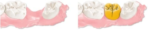 Maestro 3D Dental Studio V6