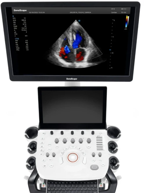 Échographe SonoScape P25 Elite