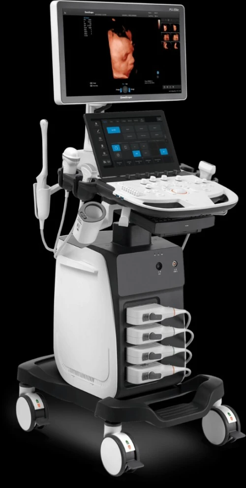 Échographe SonoScape P11 Elite