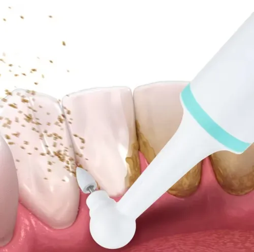 Polisseuse à dents électrique + brosse