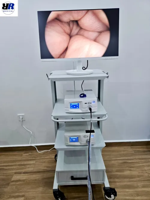 Caméra full HD + source de lumière