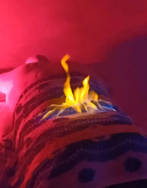 Cupping therapy ( hijama) acupuncture Chinoise flashing serviette de feu