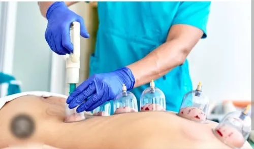 Hidjama médicale 