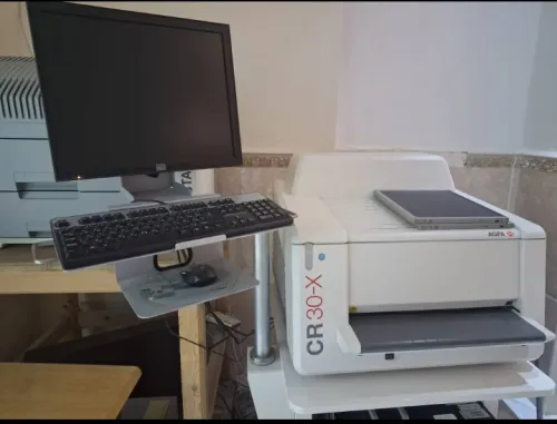 Radiologie Numeriseur AGFA CR30X