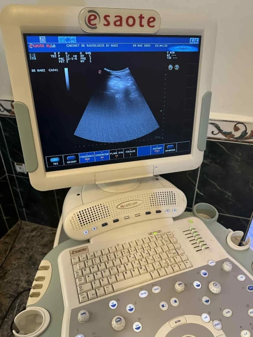 echo doppler 
