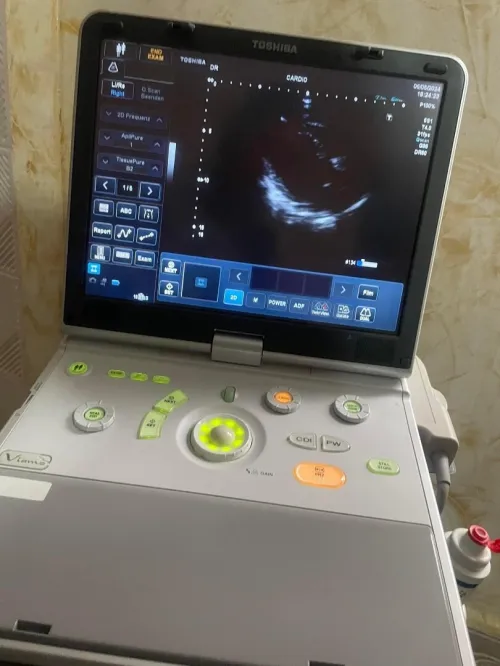 Echographe portatif TOSHIBA VIAMO