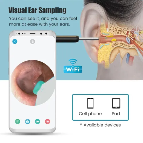 otoscope endoscope ORL Wireless