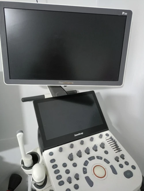 Échographe sonoscape p 20 