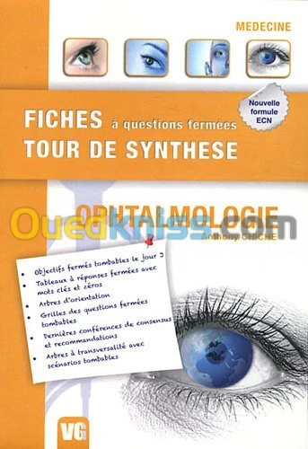 Fiches tour de synthèse Ophtalmologie