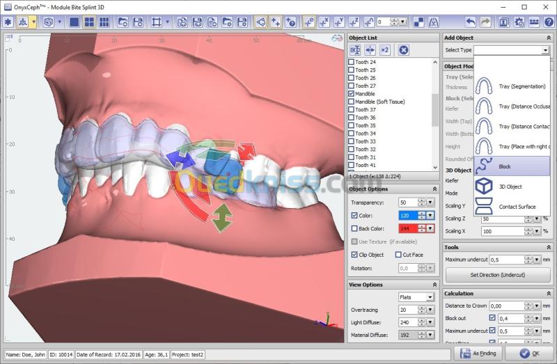 OnyxCeph 2026 Build 3.2.244(668) 5