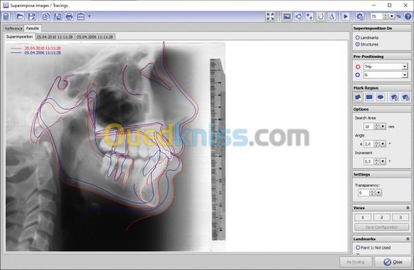 OnyxCeph 2026 Build 3.2.244(668) 8